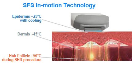 SFS in motion technology