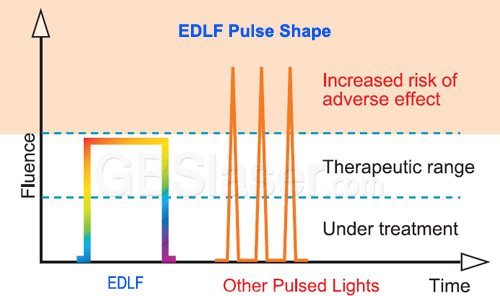 laser hair removal, intense pulsed light