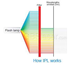 IPL work