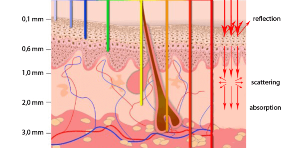 The desired interaction of these ablative lasers is to precisely remove ...