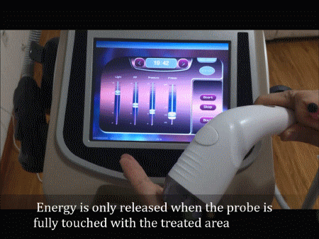 ultrasonic liposuction machine for sale