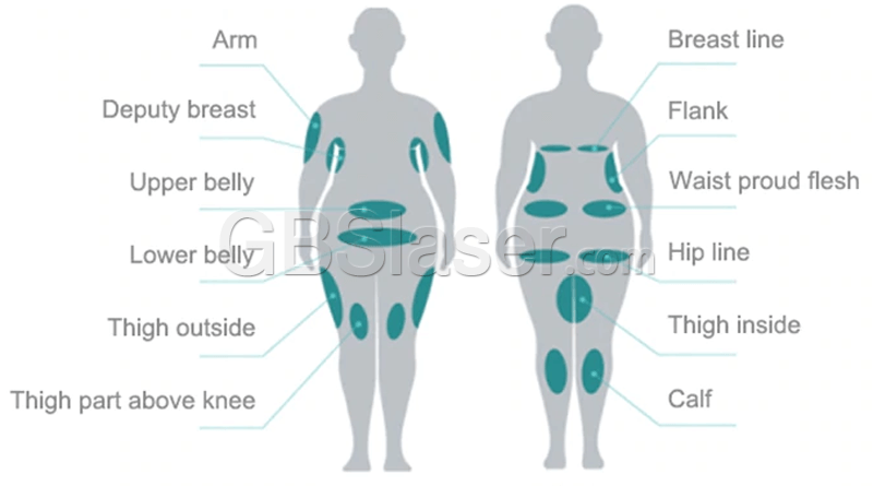 cryolipolysis machineTreatment area