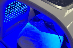 quantum light LED machine blue light therapy for acne scar